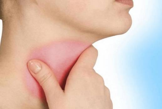 Болит горло голова и глаза без температуры