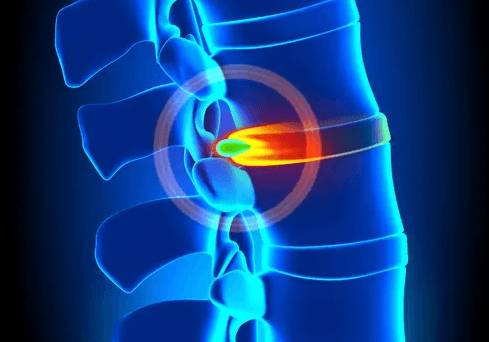 Болит спина в области лопаток отдает в шею