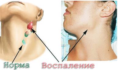 С чем связана температура и болит спина