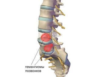 Почему болит спина если долго стоять