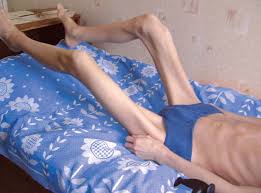 Болит нижняя часть спины у ребенка