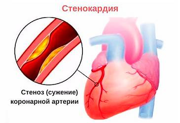 Выдыхаю и болит спина