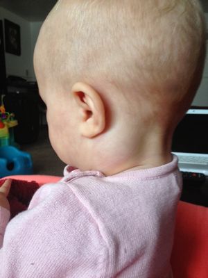 что делать если у ребенка болит шея и спина